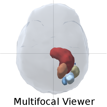 Multifocal Viewer